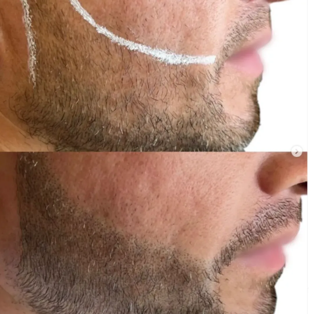 Beards