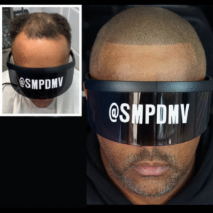 Hairline